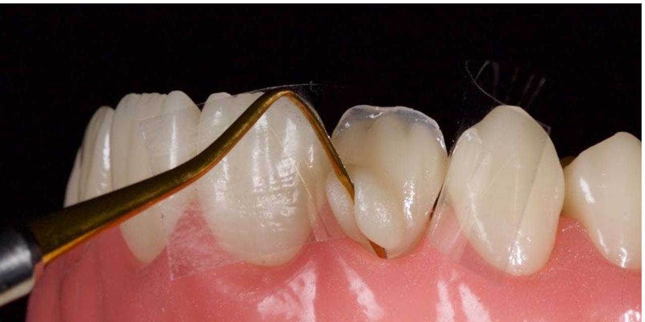 قلم کامپوزیت نچسب با روکش تیتانیوم