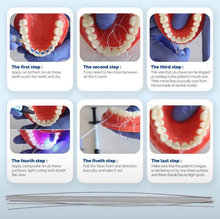 سیم ریتینر ارتودنسی آماده برای چسباندن با کامپوزیت فلو