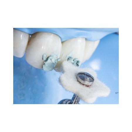 ترمیم کامپوزیت خلفی با سطح صاف و درخشان پس از استفاده از سیستم پولیش 3 مرحلهای LUCIDA DIASHINE