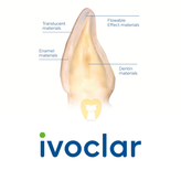 کامپوزیت ایووکلار آی پی اس IVOCLAR IPS Empress Direct
