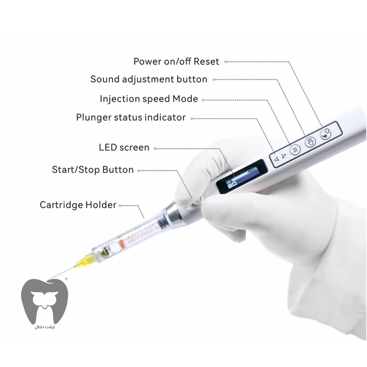 دندانپزشک در حال انجام تزریق کنترلشده با دستگاه با کیفیت Star Pen.