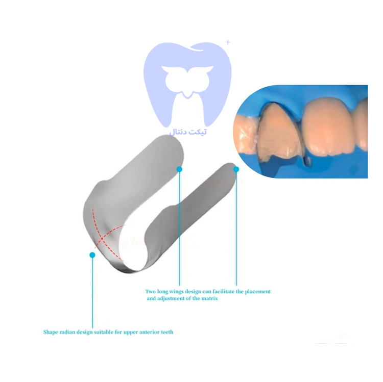 نمای نزدیک نوار ماتریس ونیر ZT-Dental برای بازسازی دقیق آناتومی لبی دندان قدامی