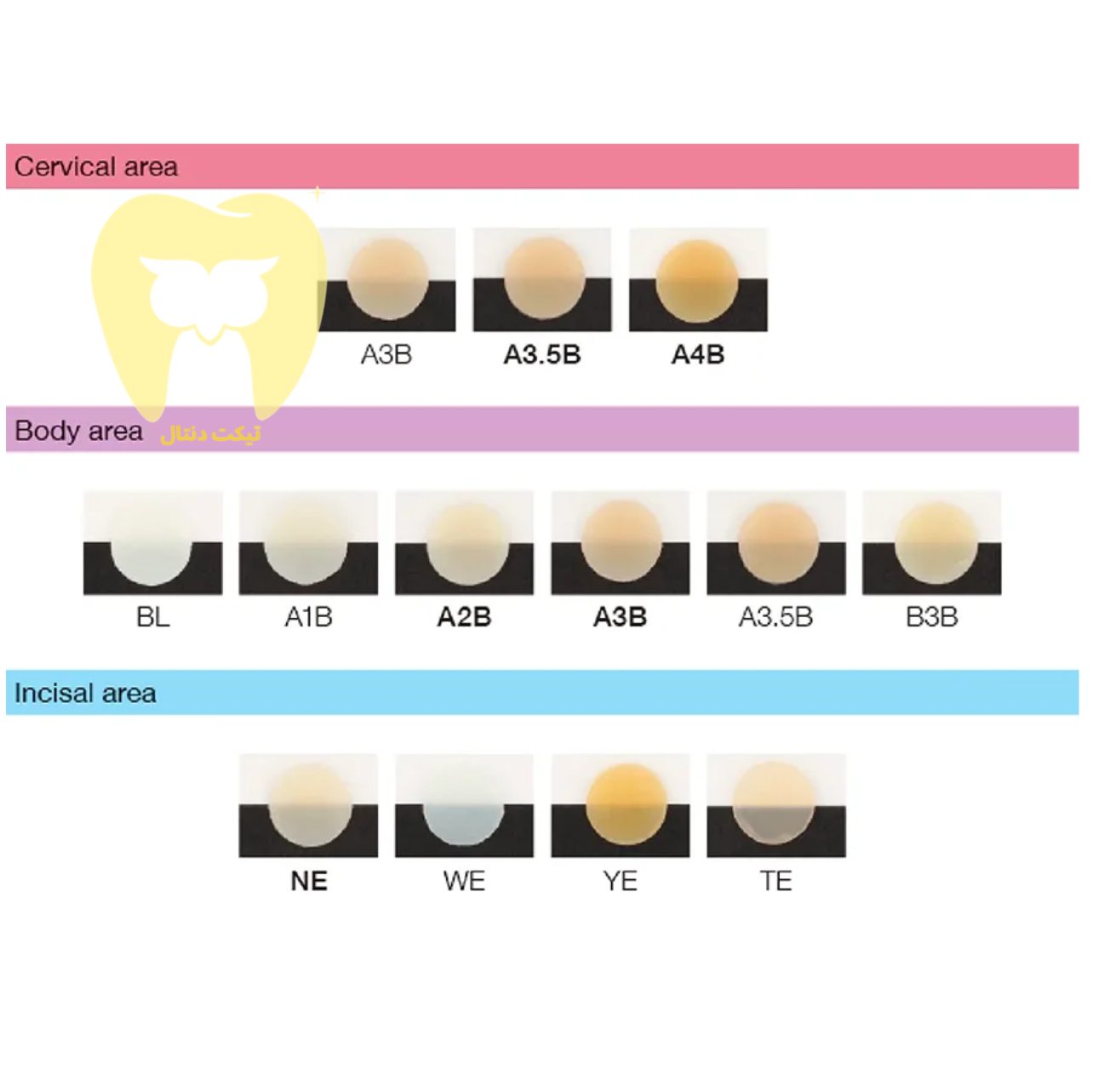 تصویر شماتیک دندان قدامی با دو لایه دنتین (Body) و انامل (Enamel) کامپوزیت آستریا در تکنیک لایه‌بندی.