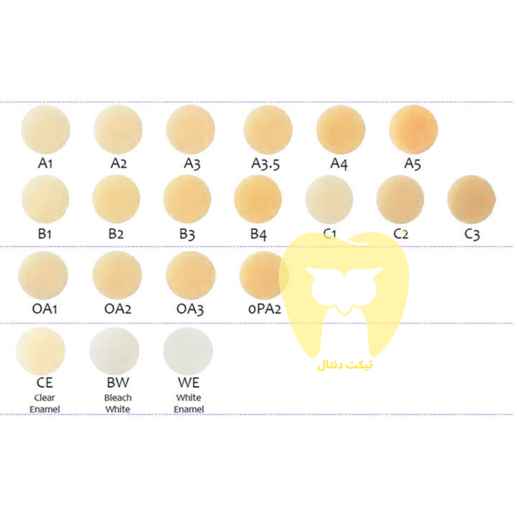 نمای نزدیک از یک ترمیم کلاس IV (لب پریدگی) در دندان قدامی که به دلیل اثر آفتابپرست، کاملاً با مینای طبیعی دندان ترکیب شده است.