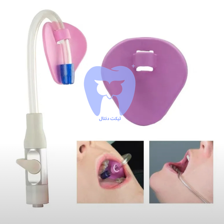 تصویر نزدیک از نگهدارنده ساکشن صورتی که به لوله مکش HVE متصل شده و آماده قرارگیری در دهان بیمار است.