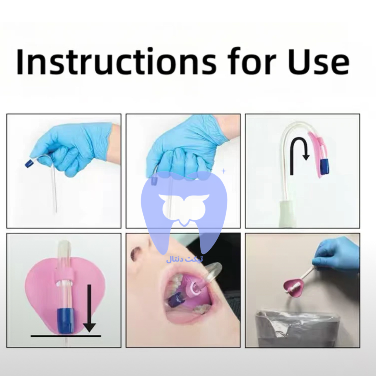 نمای نزدیک از طراحی نگهدارنده که قابلیت چسبندگی هوایی و وزن سبک آن را در دهان نشان می‌دهد.