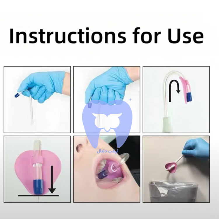 نمای نزدیک از طراحی نگهدارنده که قابلیت چسبندگی هوایی و وزن سبک آن را در دهان نشان میدهد.