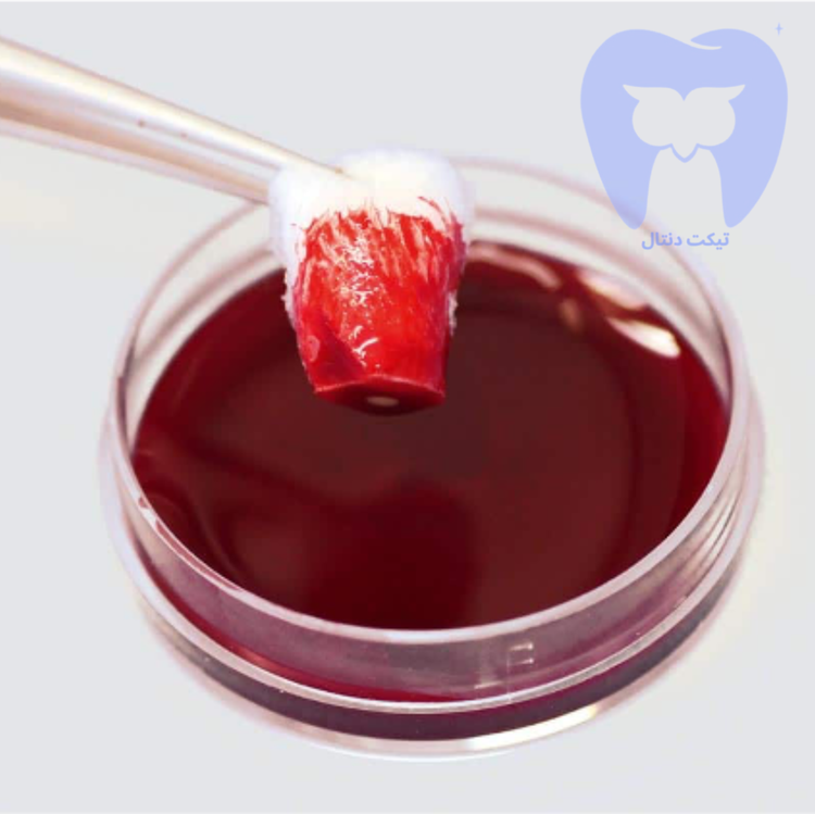 مخروط کلاژن طبیعی collacone با قابلیت جذب کامل در ۴ هفته