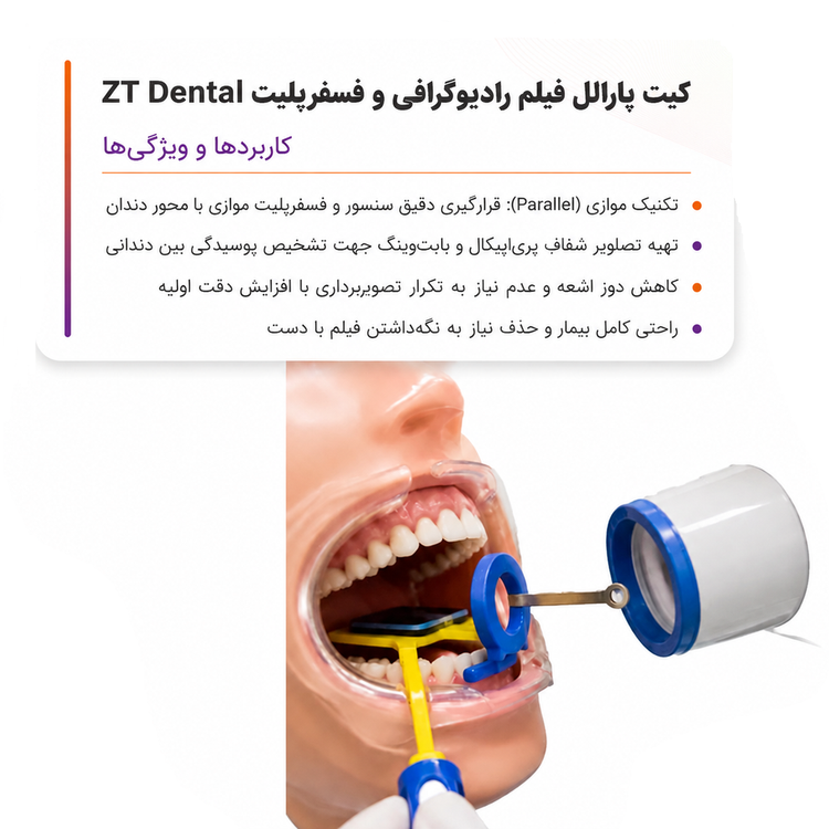 کیت پارالل فیلم رایوگرافی و فسفرپلیت ztdental